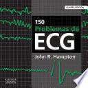 150 problemas de ECG