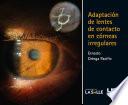 Adaptación de lentes de contacto en córneas irregulares