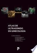 Atlas de ultrasonido en ginecología