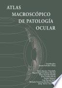 Atlas macroscópico de patología ocular