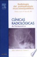 Bancroft, L.W., Clínicas Radiológicas de Norteamérica 2006, no 3: Radiología del postoperatorio musculoesquelético ©2007