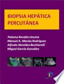 Biopsia hepática percutánea