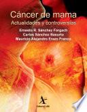 Cáncer de mama. Actualidades y controversias