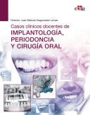 Casos clínicos docentes de IMPLANTOLOGÍA, PERIODONCIA Y CIRUGÍA ORAL