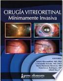 Cirugía Vitreoretinal Mínimamente Invasiva