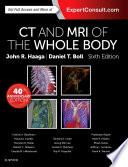Computed Tomography & Magnetic Resonance Imaging Of The Whole Body E-Book