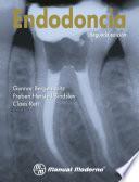 Endodoncia