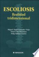 Escoliosis Realidad Tridimensional