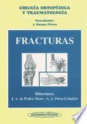 Fracturas