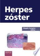 Herpes zóster