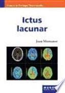Ictus lacunar
