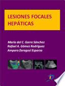 Lesiones focales hepáticas