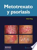 Metotrexato y psoriaris