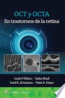 Oct Y Angiografía de Oct En Trastornos de la Retina