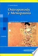 Osteoporosis y menopausia / Osteoporosis and Menopause