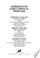 Pathology of Early Cervical Neoplasia