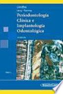 Periodontologia Clinica E Implantologia Odontologica