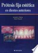 Protesis Fija Estetica En Dientes Anteriores