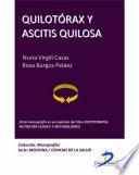 Quilotórax y ascitis quilosa