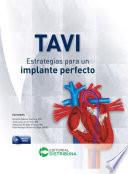 TAVI - Estrategias para un implante perfecto